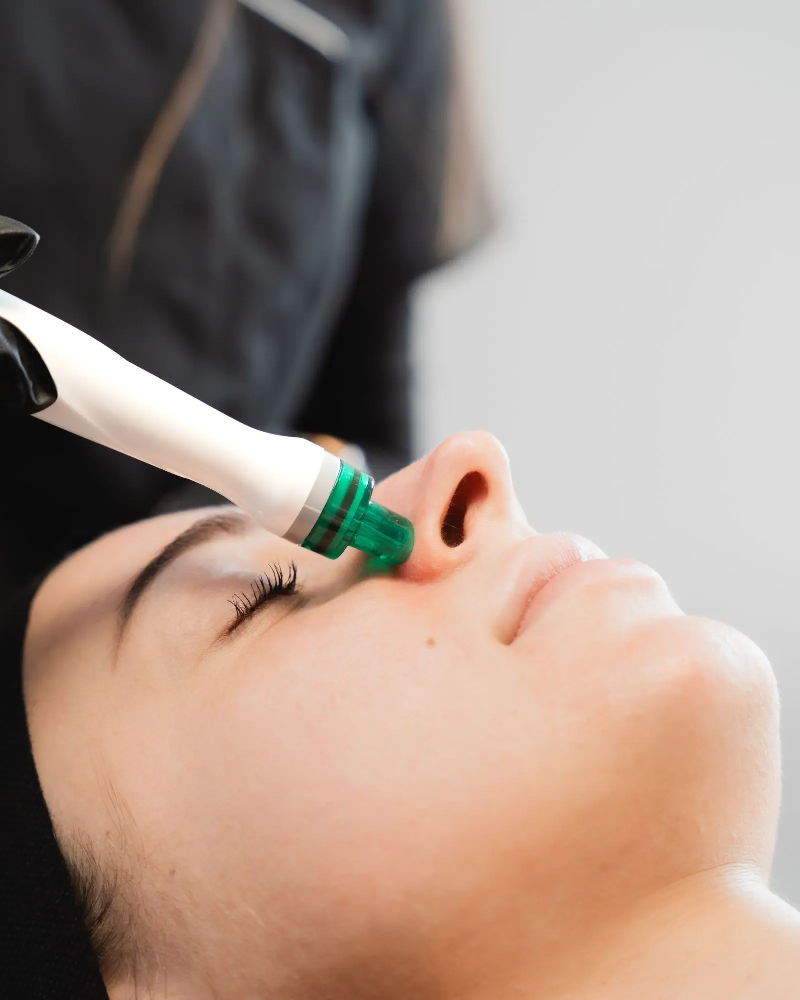 SkinPen microneedling behandeling bij Dermaé in Landgraaf voor huidverbetering, collageenstimulatie en verfijning van de huidstructuur.