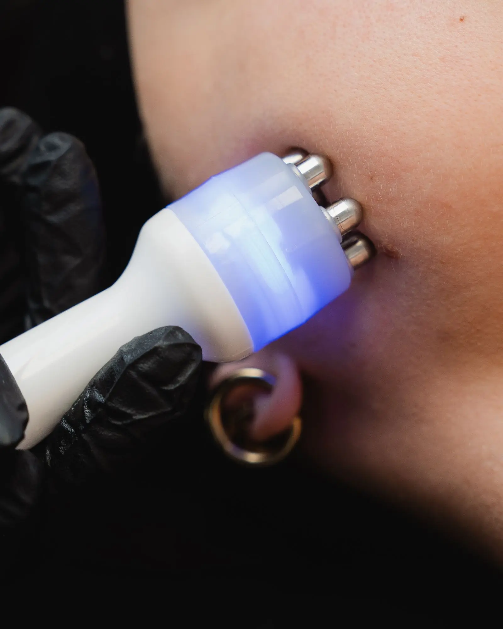 Sutech facial behandeling bij Dermaé in Landgraaf voor diepe reiniging en hydratatie van de huid.