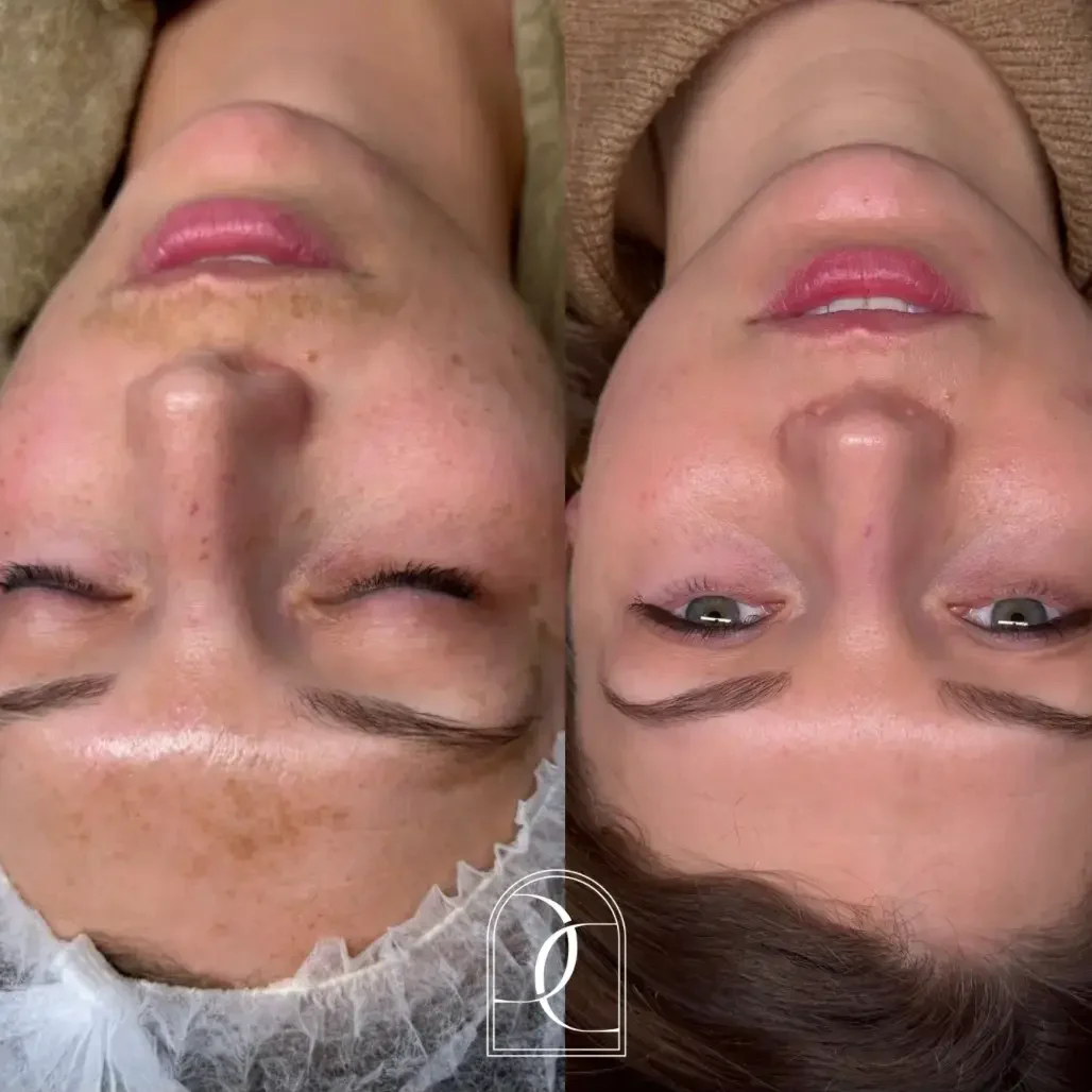 voorennacosmelan kopie