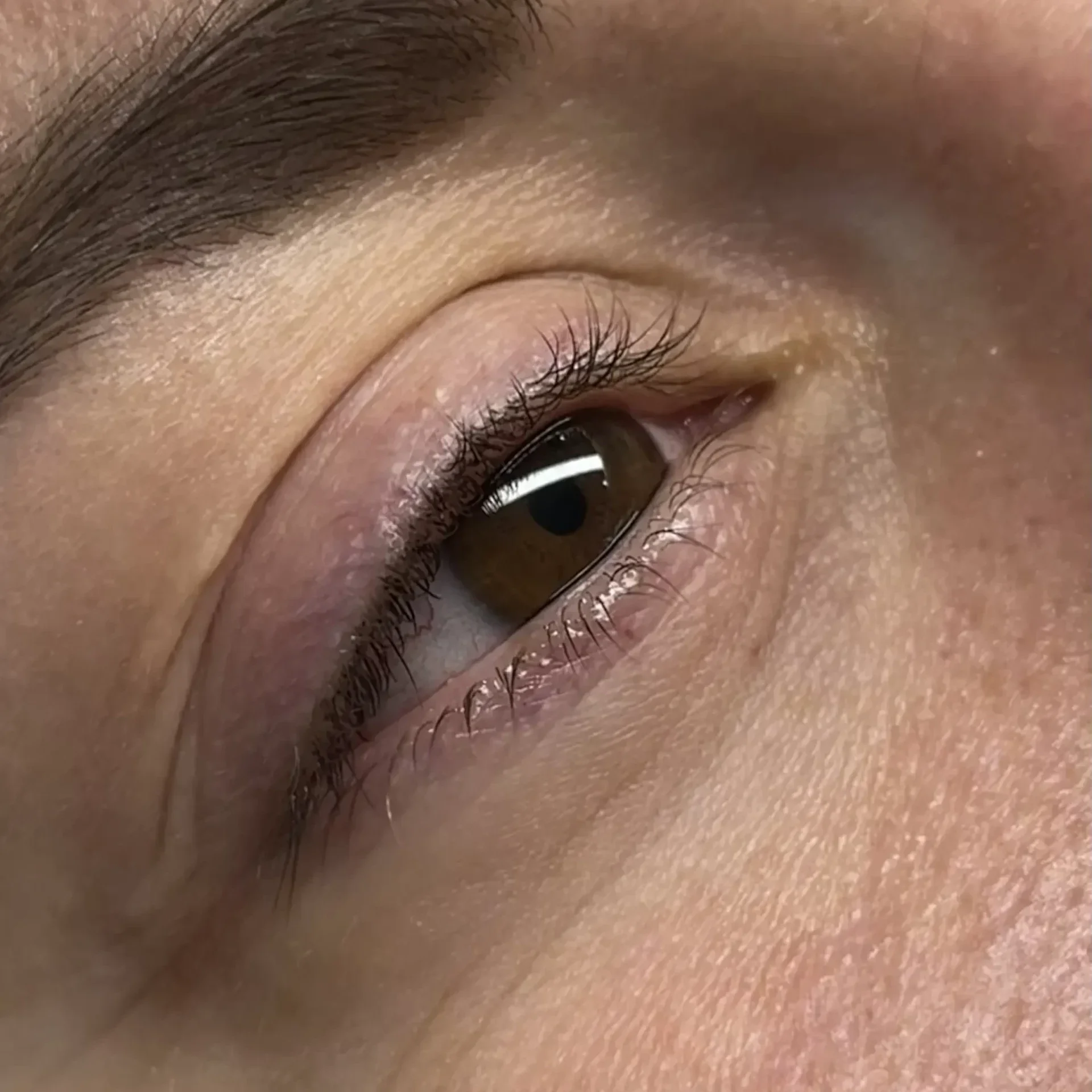 voorfotoskinpen.model1